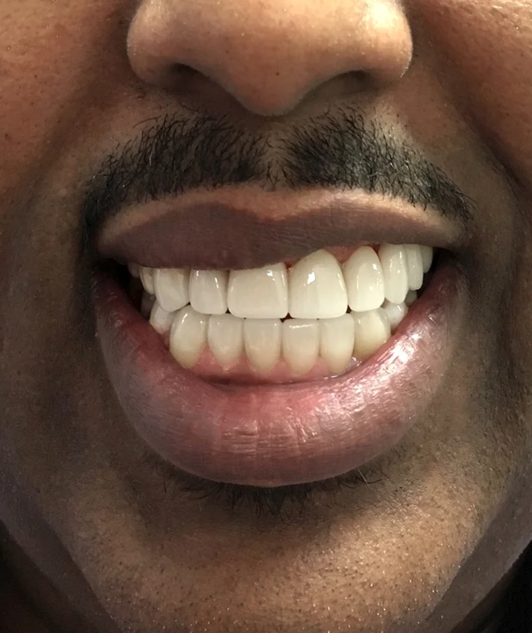 After cosmetic work treatment