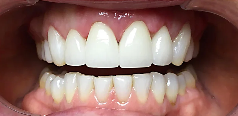 After cosmetic work treatment