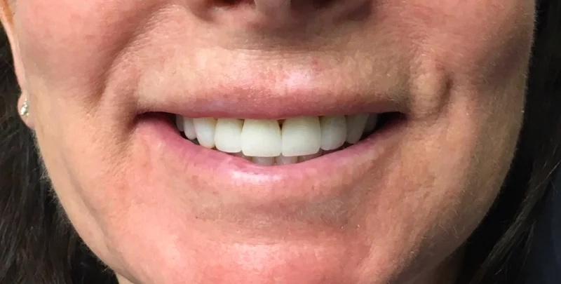 After cosmetic work treatment