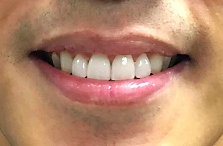 After cosmetic work treatment